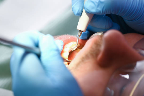 Best Emergency Wisdom Teeth Removal in El Lago, TX